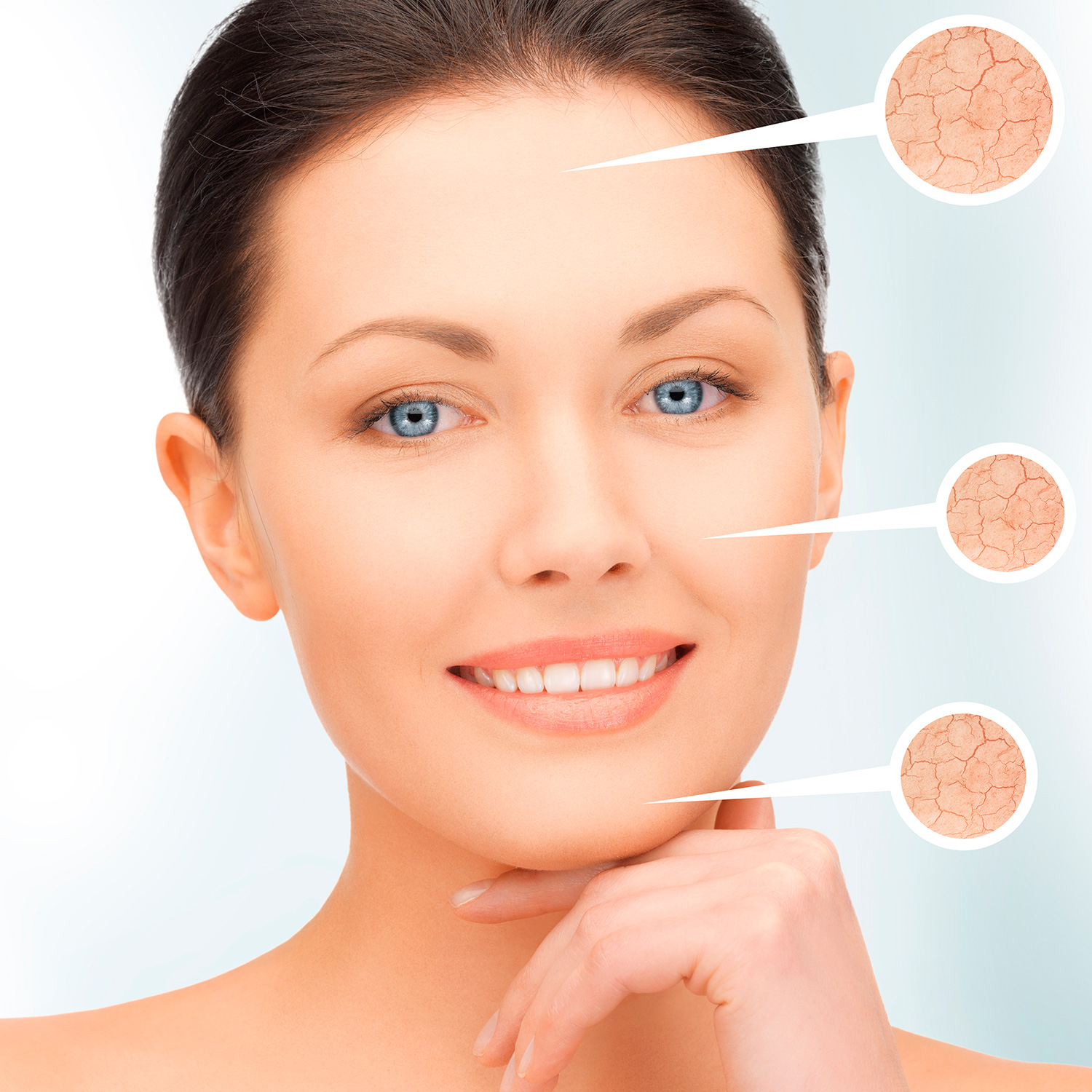 Aqua Beauty Salon Dublin IPL Red Vein Treatments